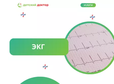 ЭКГ